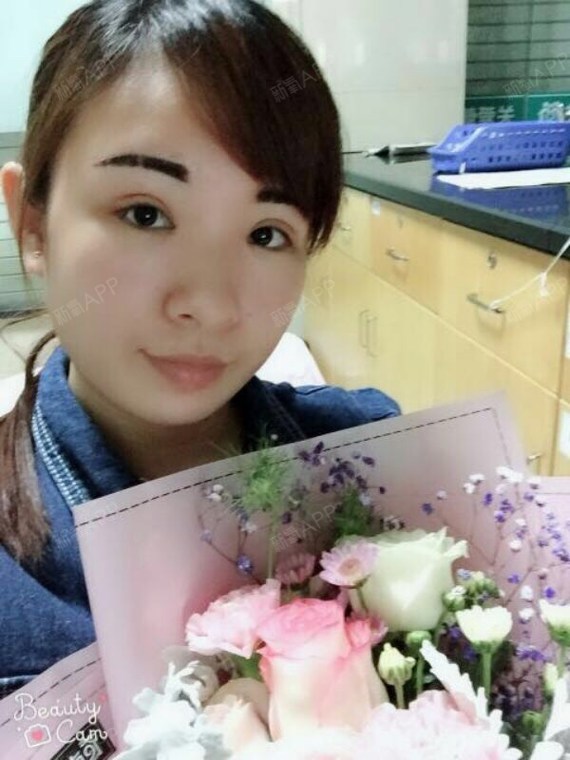 男生们是非开内眼角第58天美丽日记-新氧美容