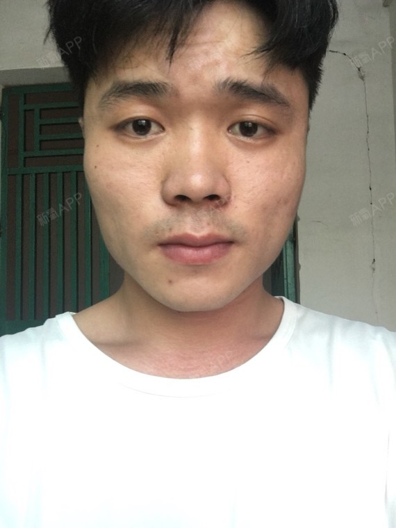 正面照