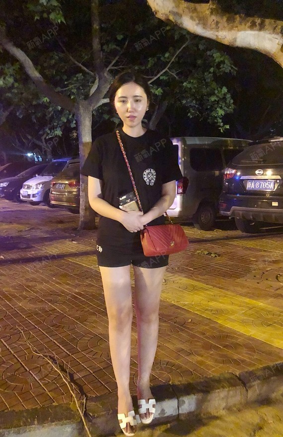 吸脂瘦大腿好不好_效果图_小岳岳呀吸脂瘦大腿术后第