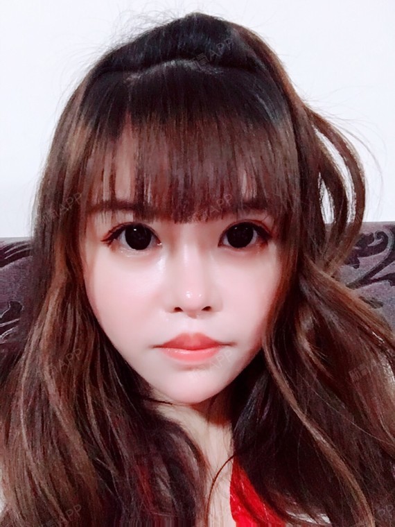 爱美的兔子520人中缩短术术后第158天美丽日记_新氧
