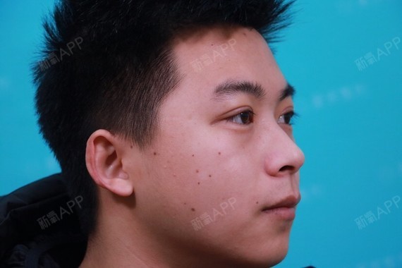 氧气2805171528621982眼部综合第7天美丽日