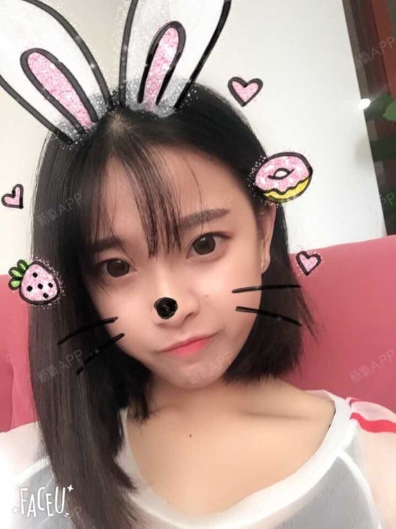 【美莱整形】除狐臭的作用效果肉毒素治疗狐臭