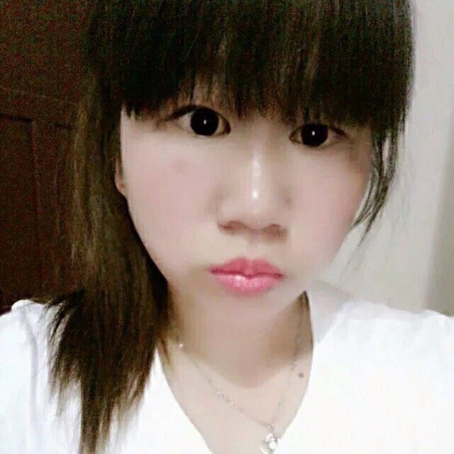 北京画美医疗美容医院(原长虹整形)处女膜修复怎么样_恢复过程_效果