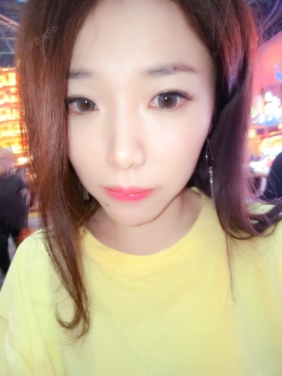 黑漆漆七七隐形托槽矫正第152天美丽日记-新氧