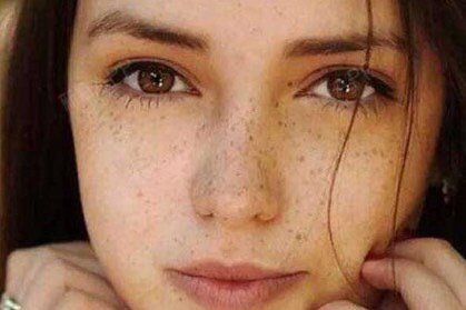 皮秒祛斑多少钱一次,皮秒祛斑的价格,吐槽!皮秒