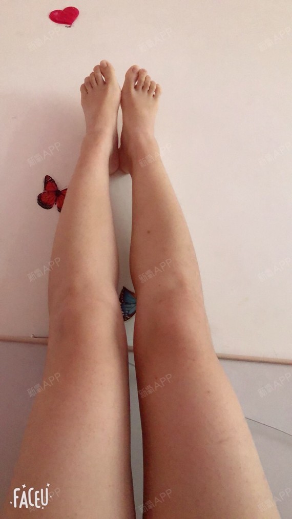 希尔Ciel肉毒素瘦小腿第11天美丽日记-新氧美