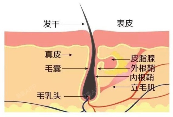 【关于植发的毛囊单位问题】