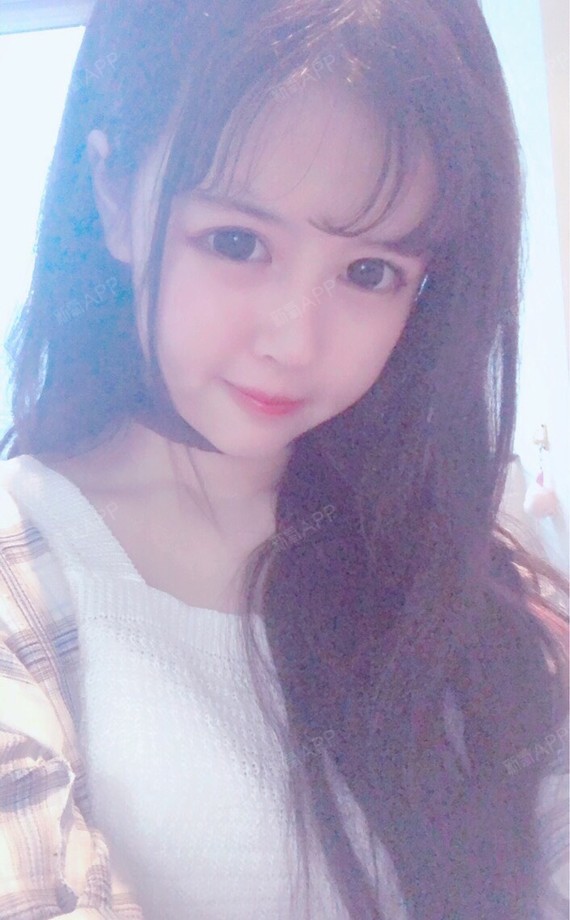 你过来亲我一下开内眼角第560天美丽日记-新氧