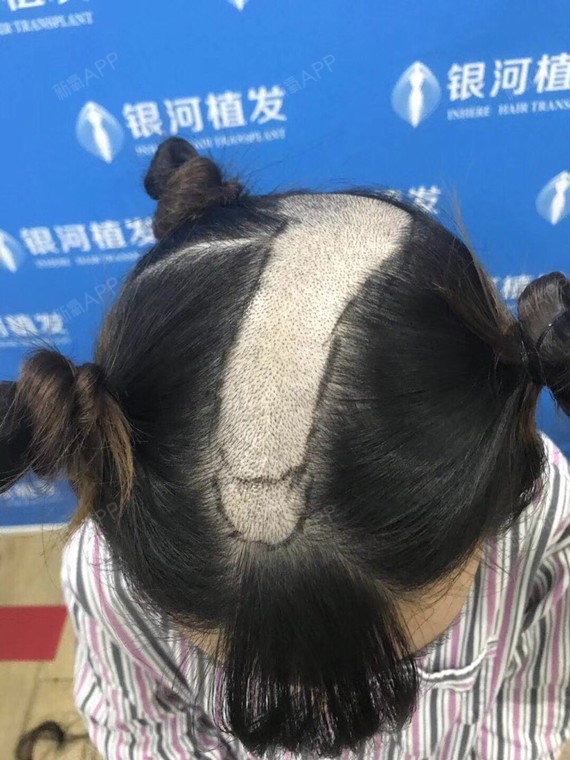 今天的女性发缝加密