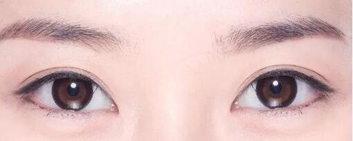 南昌佳美整形眼部整形术后要多休息?很多人认