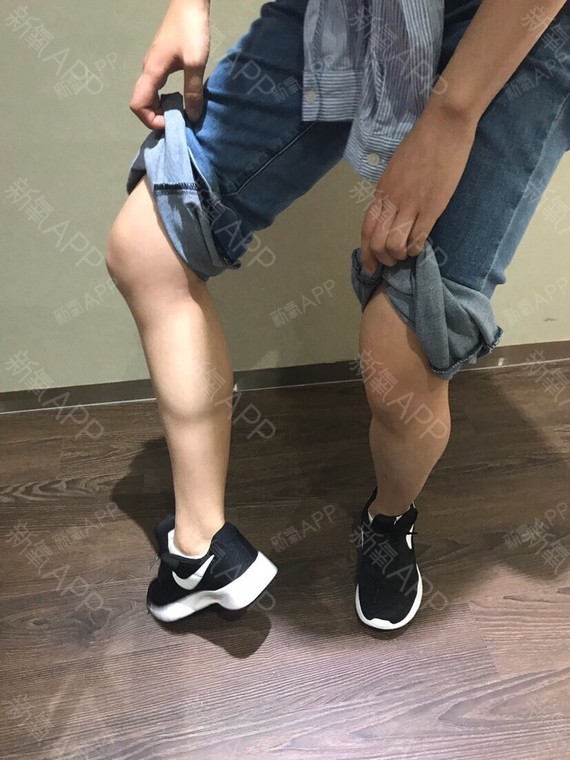 瘦腿针攻略-记录我肌肉腿变大长腿的全过烫