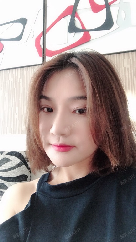 陌爱87埋线提升第30天美丽日记-新氧美容整形