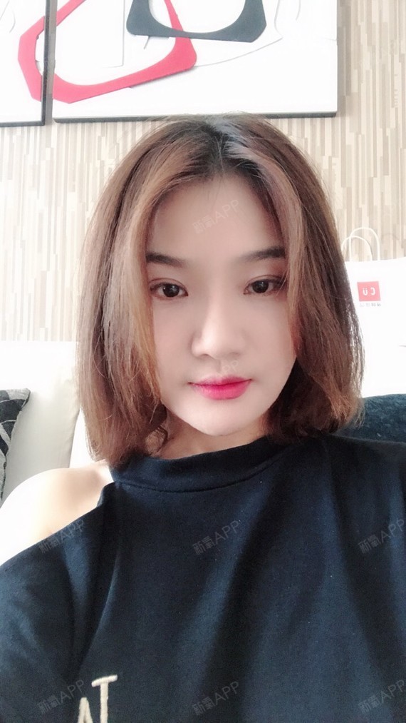 陌爱87埋线提升第30天美丽日记-新氧美容整形