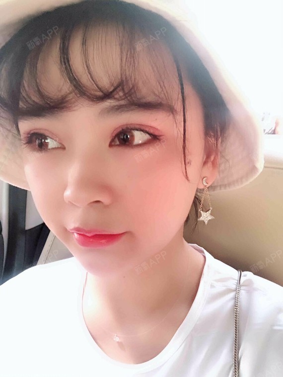 【美莱整形】激光祛痘适合什么样的痘痘?激光