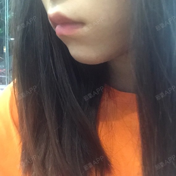 我这个嘴唇应该怎么做阿,感觉上嘴唇是凸出来
