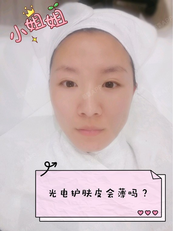 像皮秒、超声刀等光电类护肤次数多了,皮肤会