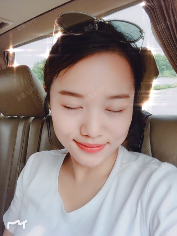 玻尿酸隆下巴