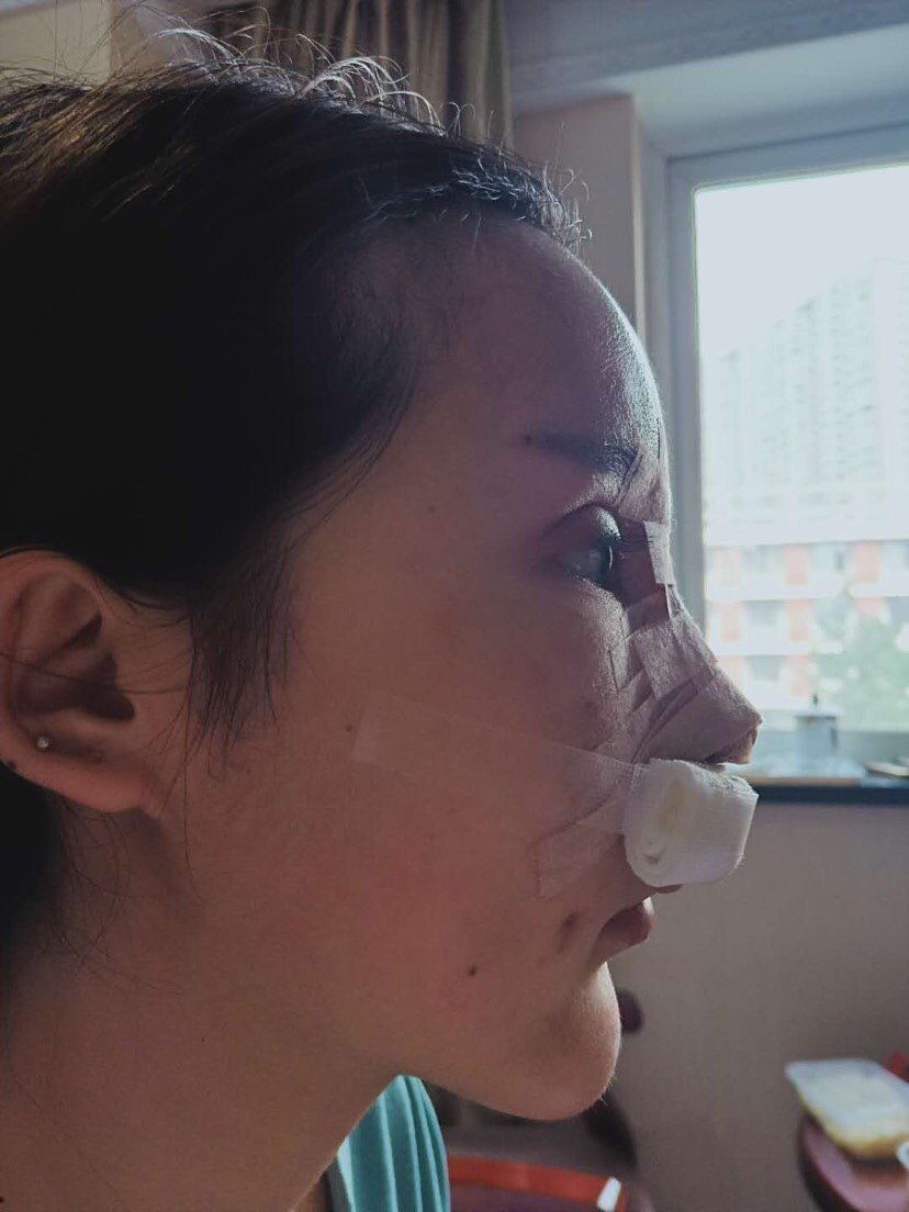 后来对自己的要求越来越高了,开始留意到鼻头,朝天鼻漏鼻孔,侧面都