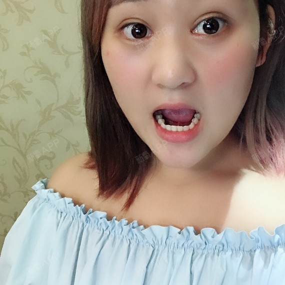 日记就是怪自己太懒了,原谅我哦,洗完牙的感觉还是美美哒,平价的洗牙