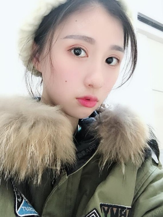 新月型双眼_圈子-新氧美容整形