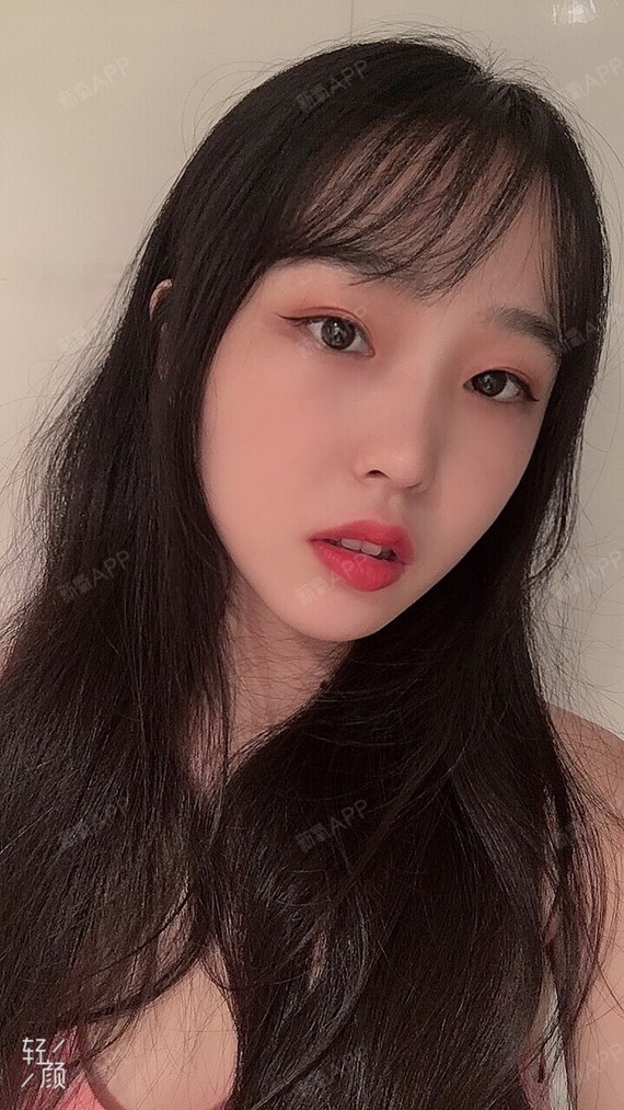 武汉激光祛斑好不好_效果图_sweetfox激光祛斑术后第