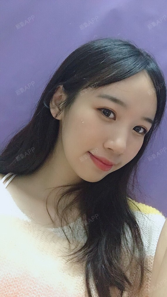 小小11定点双眼皮第147天美丽日记-新氧美容