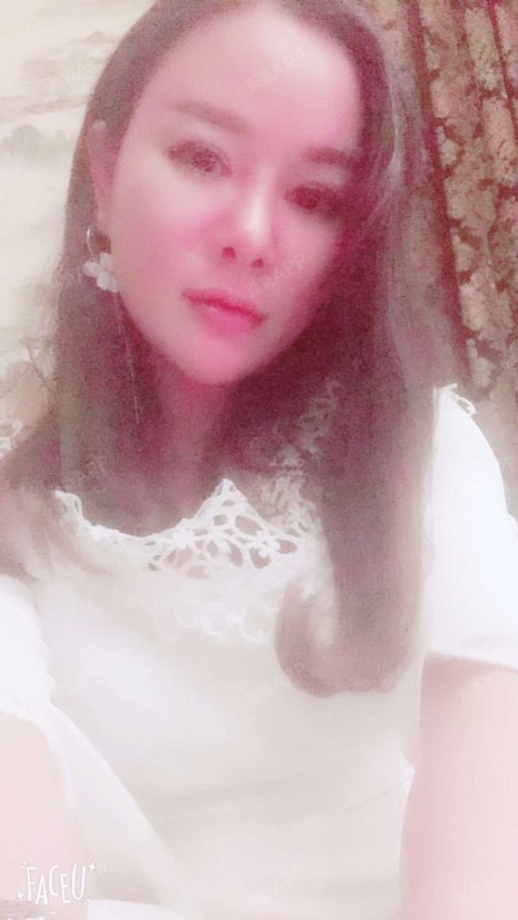 满头杨花共白首df自体脂肪全脸填充第45天美丽