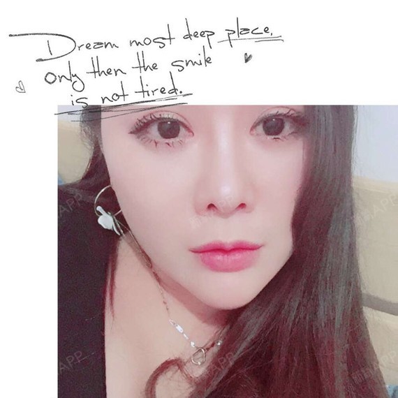 满头杨花共白首df自体脂肪全脸填充第45天美丽