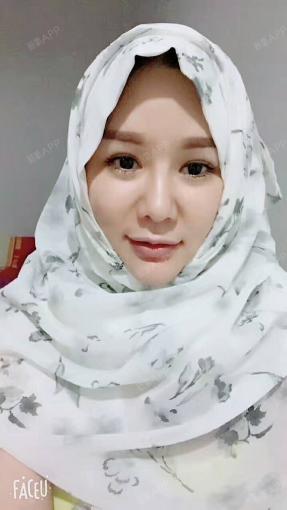 满头杨花共白首df自体脂肪全脸填充第90天美丽