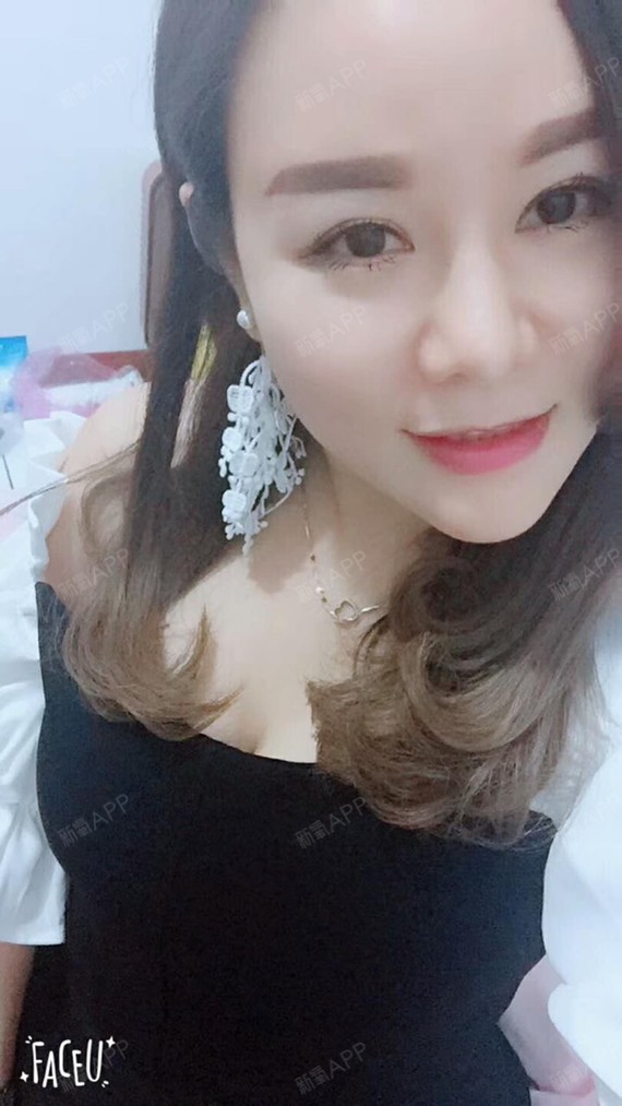 满头杨花共白首df自体脂肪全脸填充第90天美丽