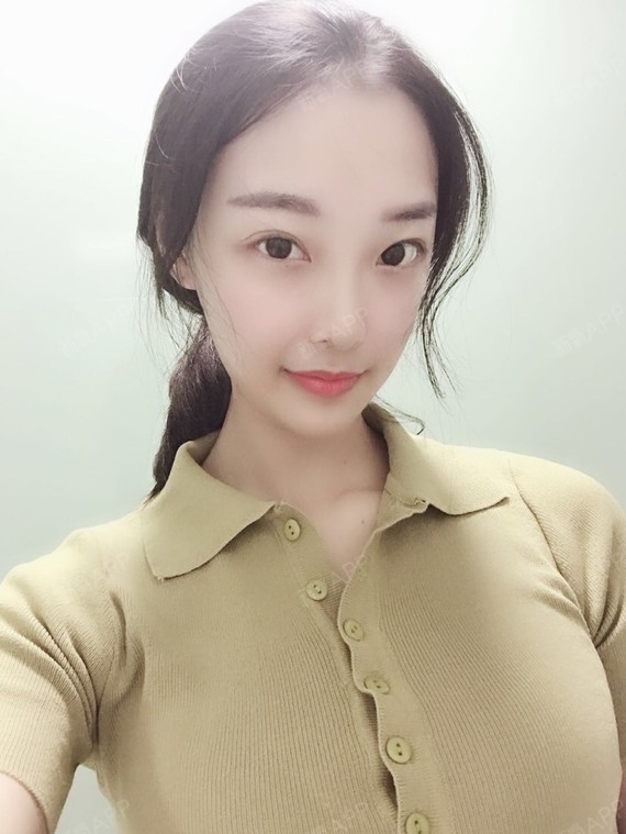 新氧- 大壮实 | 胸部 | 隆胸 | 假体隆胸 | 术后当自强 | 北京同城