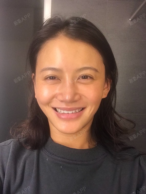 我看起来土,老,面部下垂27了到底哪里该整可以