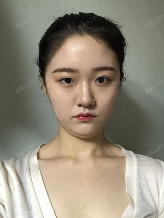 主要是没下巴,都说下巴兜财,没下巴怎么行,还有我身子不胖,就唯独脸部