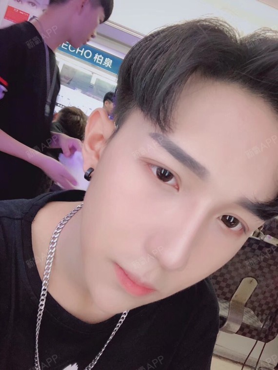 不该干脆fe手术缩鼻头第382天美丽日记-新氧美