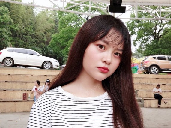 防御物质9硅胶隆鼻第355天美丽日记-新氧美容