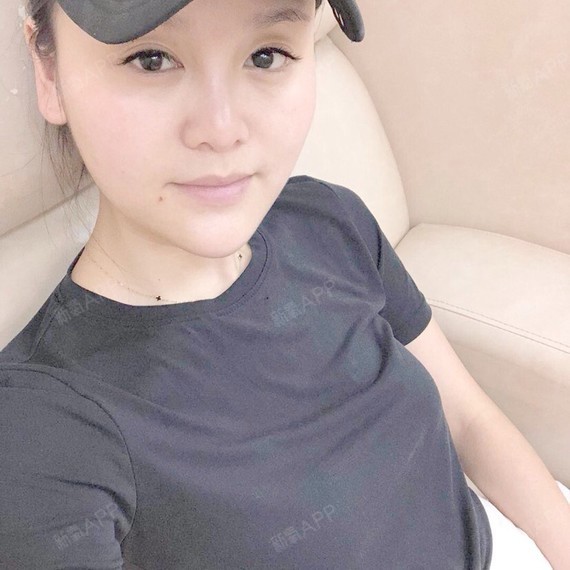 大不了唱首歌美白针第16天美丽日记-新氧美容