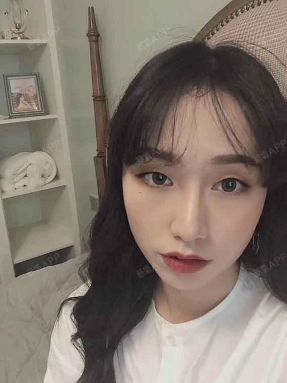 积极笠我手术缩鼻头第386天美丽日记-新氧美容