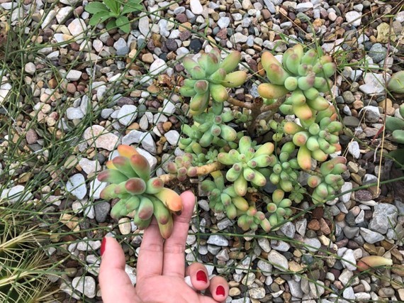 我要做辣妈假体隆胸第112天美丽日记-新氧美容