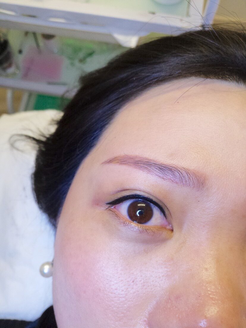 上海柔初美容半永久美瞳线怎么样_恢复过程_效果如何