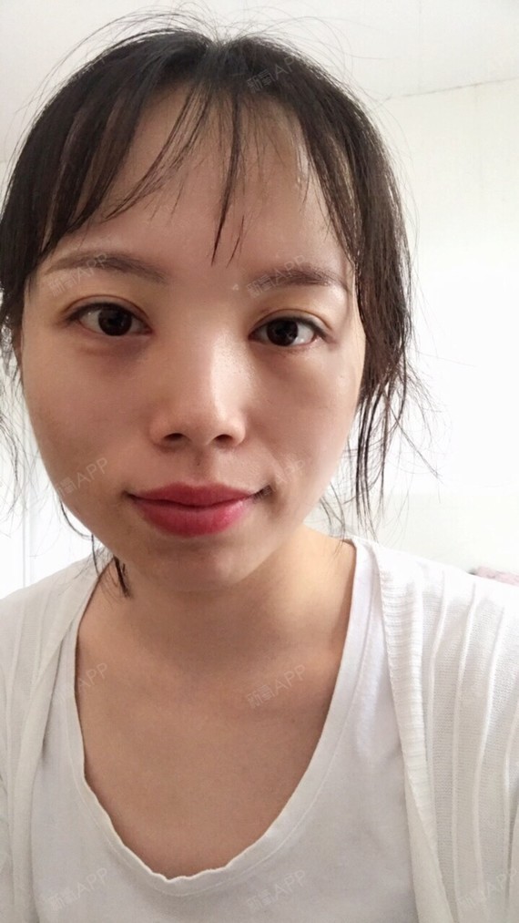 管用瘦脸针不能快半个月了,效果有点明显,有几个朋友见了都问我是一晃量石塑身衣注射吗图片