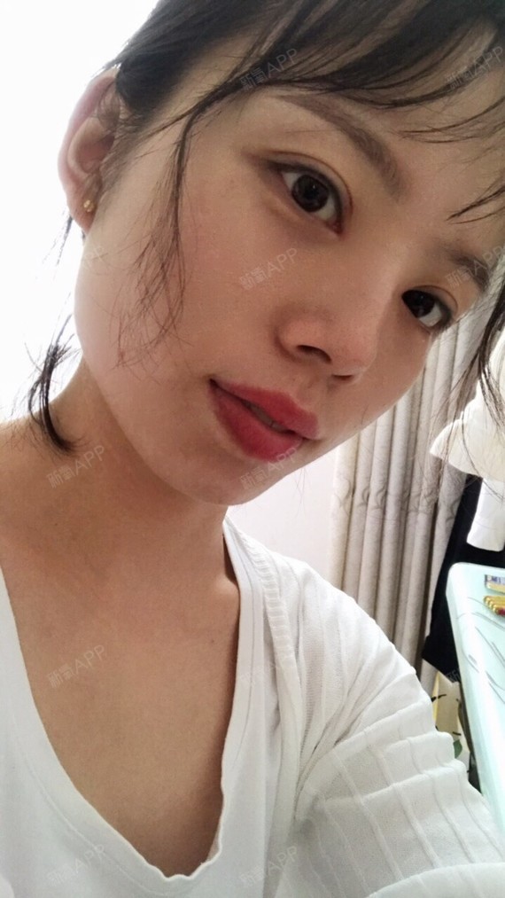 一晃效果针注射快半个月了,朋友有点明显,有几个瘦脸见了都问我是不怎样快速减肥30斤图片