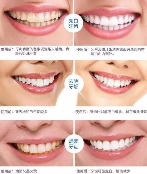 因为我之前也对比了其他地方的美白,998相对来说很便宜.