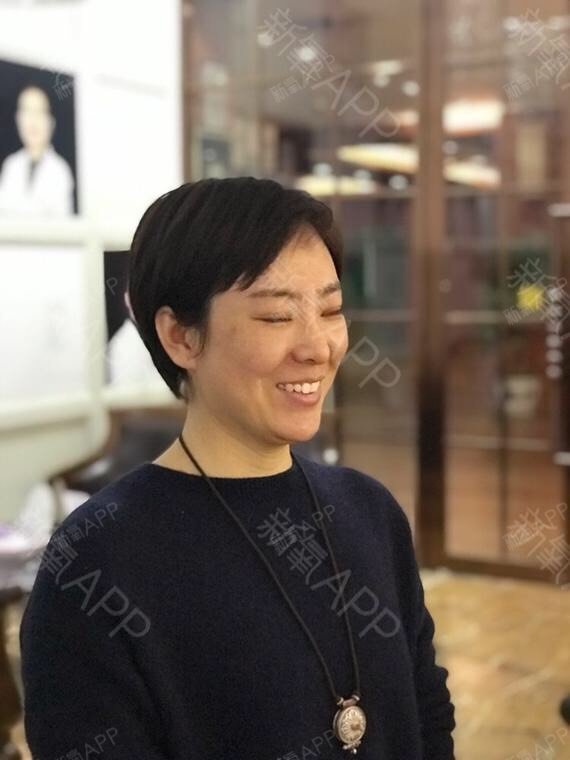 夕夕a埋线提升第1天美丽日记-新氧美容整形