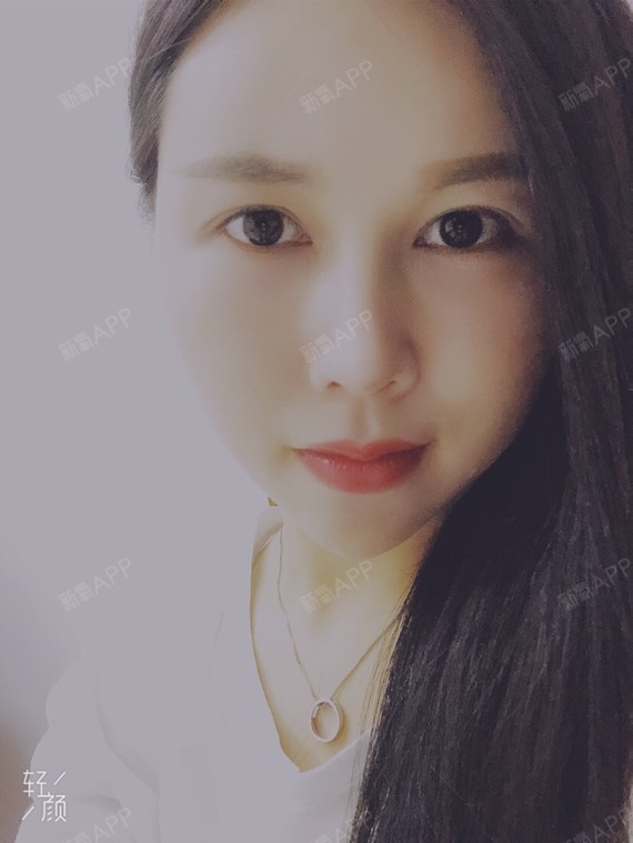 氧气0735661523361621肉毒素瘦脸第37天美