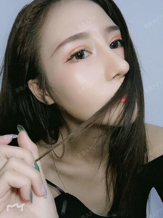 肋软骨隆鼻
