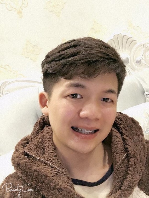 这样看其实还好,垫高了牙齿,上下牙咬合不到一起
