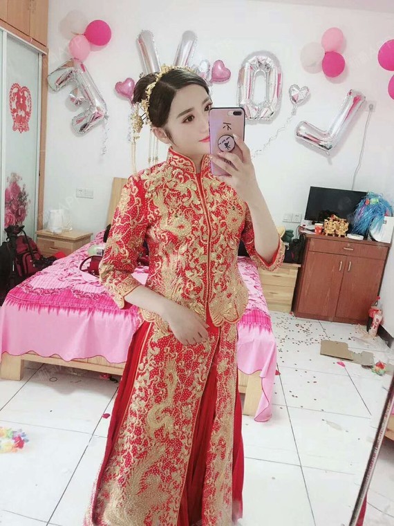 想念不如怀念种植发际线第332天美丽日记-新氧