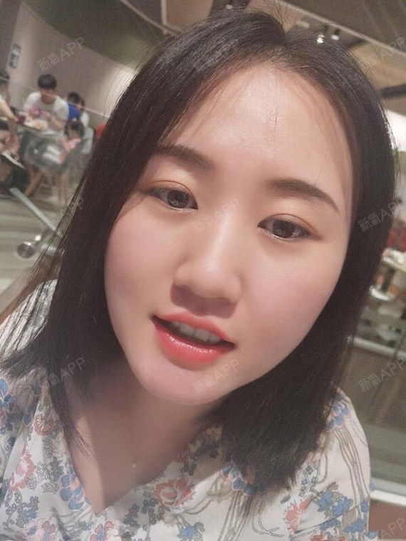 木木没有眼泪超微小气泡第0天美丽日记-新氧美