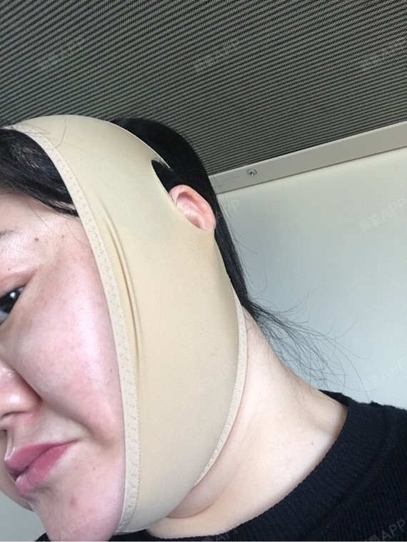 张