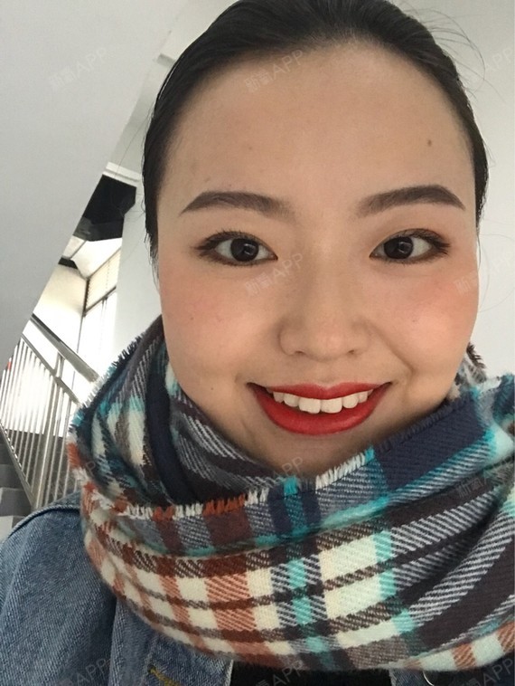 Rylynn面部吸脂第102天美丽日记-新氧美容整形